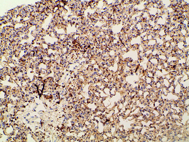 Phospho-PI3K p85 alpha (Tyr607) Antibody in Immunohistochemistry (Paraffin) (IHC (P))