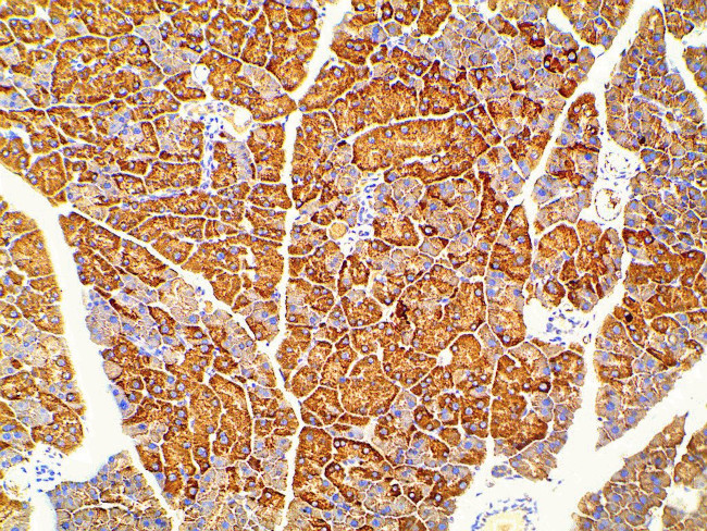 Phospho-PI3K p85 alpha (Tyr607) Antibody in Immunohistochemistry (Paraffin) (IHC (P))