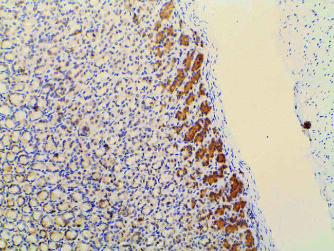 Phospho-PI3K p85 alpha (Tyr607) Antibody in Immunohistochemistry (Paraffin) (IHC (P))