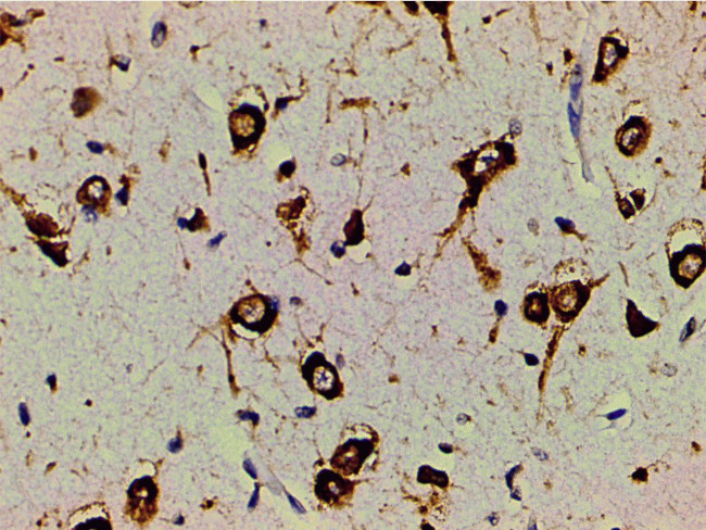 Phospho-PI3K p85 alpha (Tyr607) Antibody in Immunohistochemistry (Paraffin) (IHC (P))