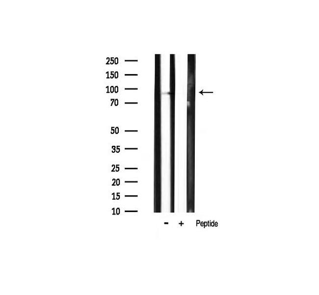 Phospho-PI3K p85 alpha (Tyr607) Antibody in Western Blot (WB)