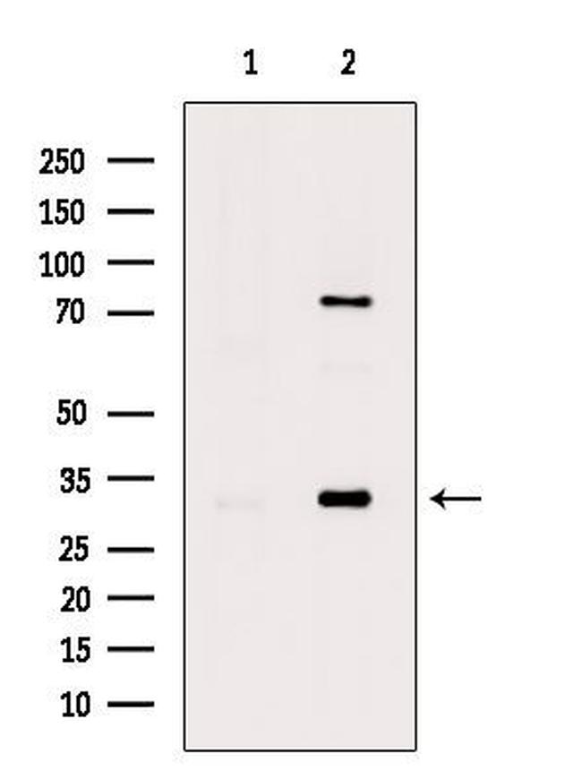 Phospho-MARCKS (Ser158) Antibody in Western Blot (WB)