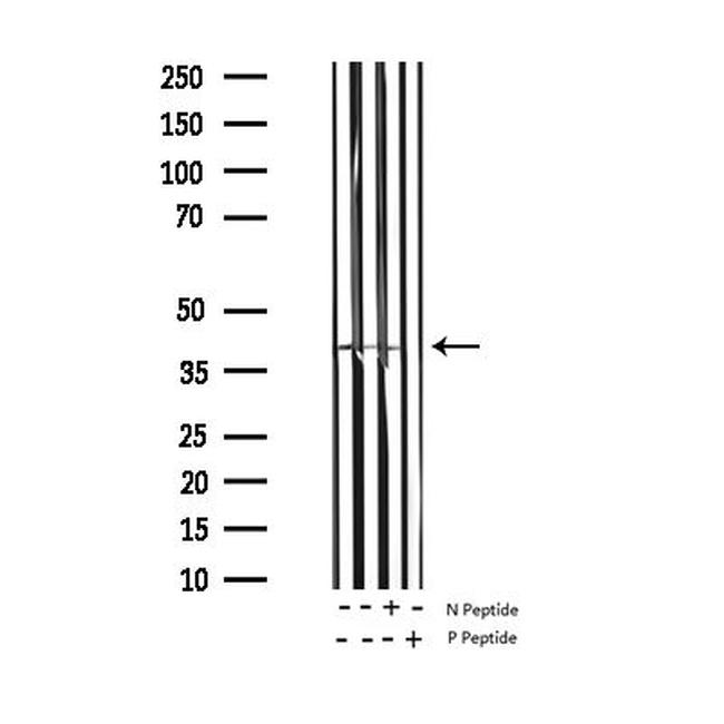 Phospho-MARCKS (Ser158) Antibody in Western Blot (WB)