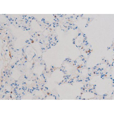 Phospho-CDC25B (Ser323) Antibody in Immunohistochemistry (Paraffin) (IHC (P))