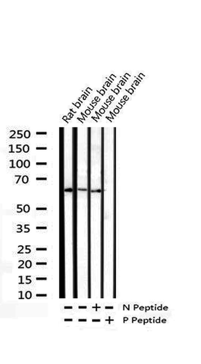 Phospho-CDC25B (Ser323) Antibody in Western Blot (WB)