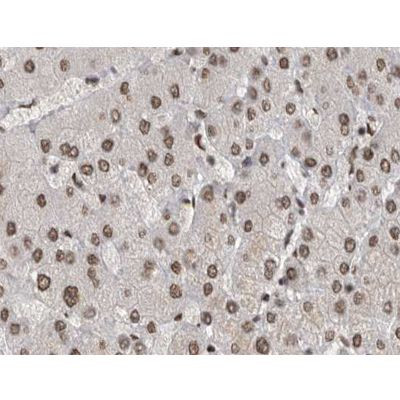 Phospho-JNK1/JNK2/JNK3 (Tyr185) Antibody in Immunohistochemistry (Paraffin) (IHC (P))