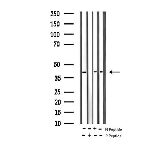 Phospho-MEK3 (Ser189) Antibody in Western Blot (WB)