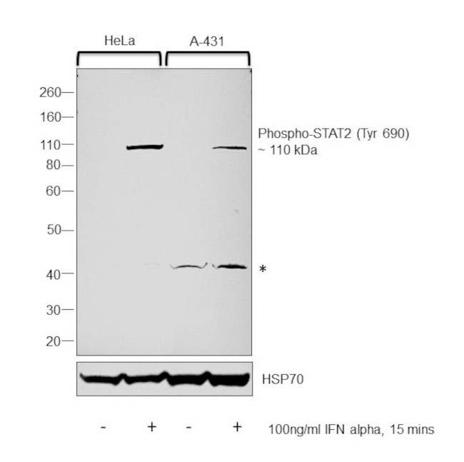 Phospho-STAT2 (Tyr690) Antibody in Western Blot (WB)