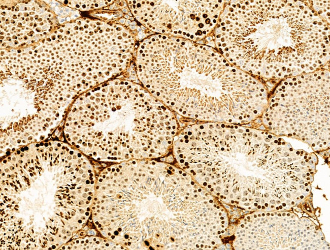 Phospho-Histone H3 (Ser11) Antibody in Immunohistochemistry (Paraffin) (IHC (P))