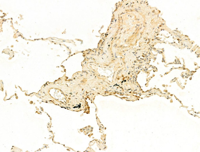 Phospho-Histone H3 (Ser11) Antibody in Immunohistochemistry (Paraffin) (IHC (P))