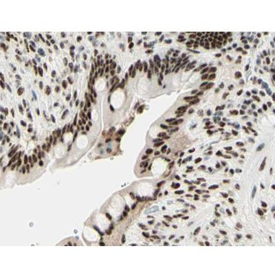 Phospho-Histone H3 (Ser11) Antibody in Immunohistochemistry (Paraffin) (IHC (P))