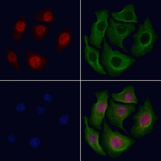 Phospho-NFkB p100 (Ser872) Antibody in Immunocytochemistry (ICC/IF)