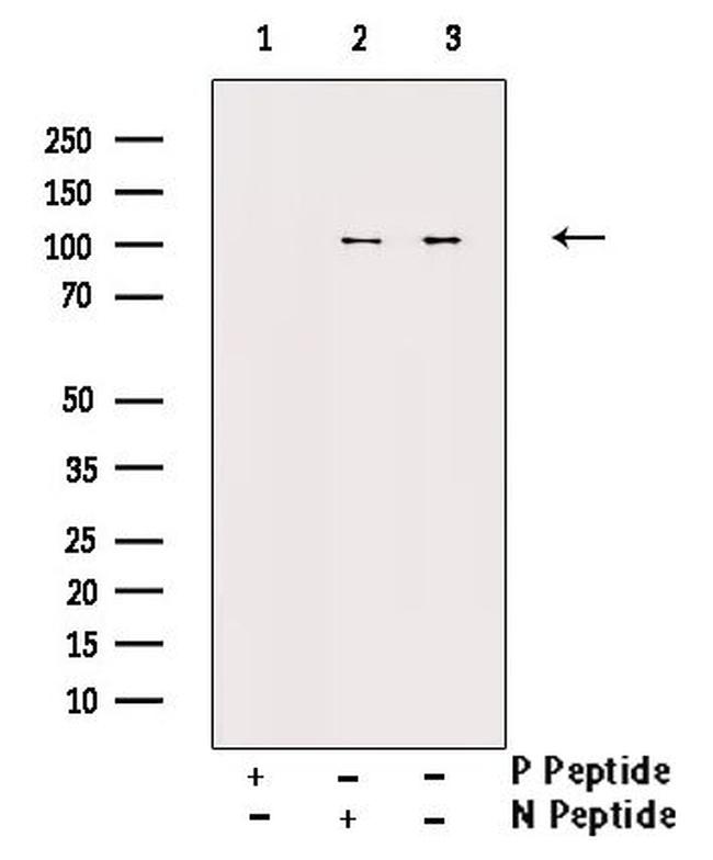 Phospho-NFkB p100 (Ser872) Antibody in Western Blot (WB)