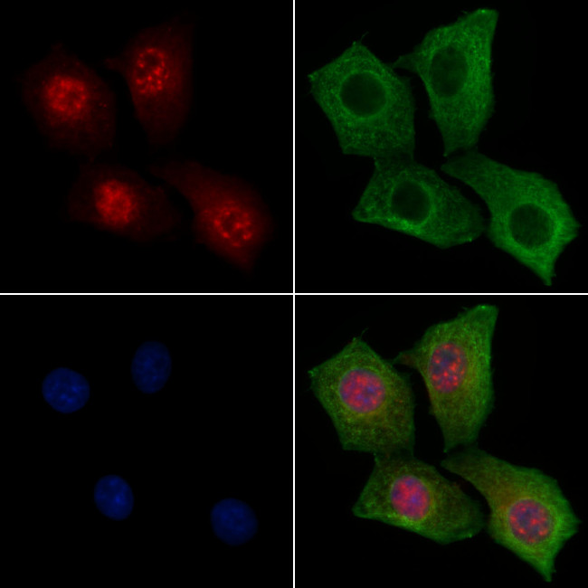 Phospho-E2F1 (Thr433) Antibody in Immunocytochemistry (ICC/IF)