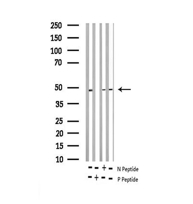 Phospho-E2F1 (Thr433) Antibody in Western Blot (WB)