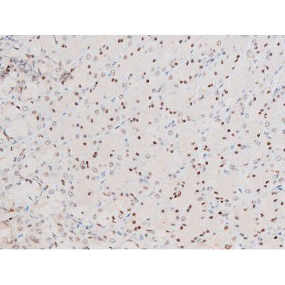 Phospho-NFkB p65 (Ser281) Antibody in Immunohistochemistry (Paraffin) (IHC (P))