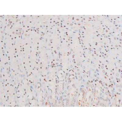 Phospho-NFkB p65 (Ser281) Antibody in Immunohistochemistry (Paraffin) (IHC (P))