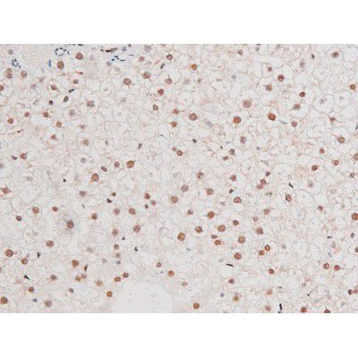 Phospho-NFkB p65 (Ser281) Antibody in Immunohistochemistry (Paraffin) (IHC (P))