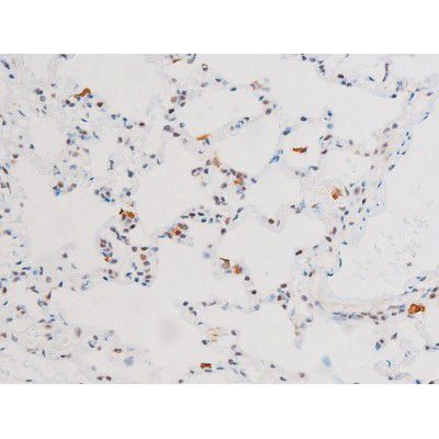 Phospho-NFkB p65 (Ser281) Antibody in Immunohistochemistry (Paraffin) (IHC (P))