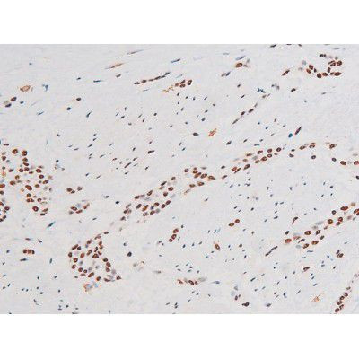 Phospho-NFkB p65 (Ser281) Antibody in Immunohistochemistry (Paraffin) (IHC (P))