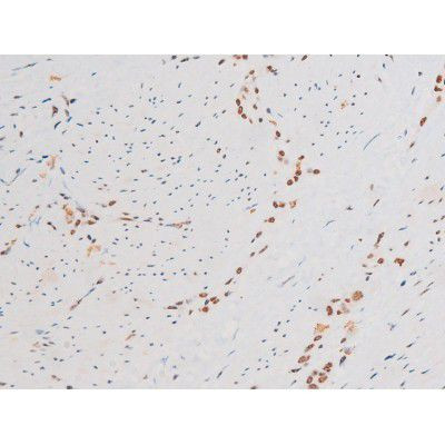 Phospho-NFkB p65 (Ser281) Antibody in Immunohistochemistry (Paraffin) (IHC (P))