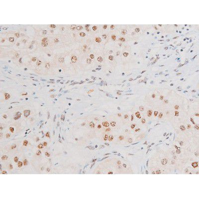 Phospho-NFkB p65 (Ser281) Antibody in Immunohistochemistry (Paraffin) (IHC (P))