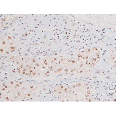 Phospho-NFkB p65 (Ser281) Antibody in Immunohistochemistry (Paraffin) (IHC (P))