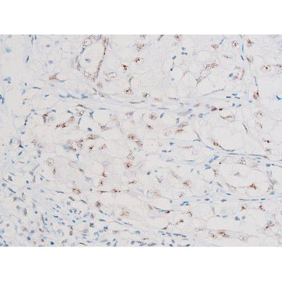 Phospho-NFkB p65 (Ser281) Antibody in Immunohistochemistry (Paraffin) (IHC (P))