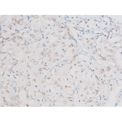 Phospho-NFkB p65 (Ser281) Antibody in Immunohistochemistry (Paraffin) (IHC (P))