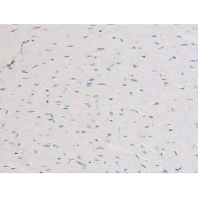 Phospho-NFkB p65 (Ser281) Antibody in Immunohistochemistry (Paraffin) (IHC (P))