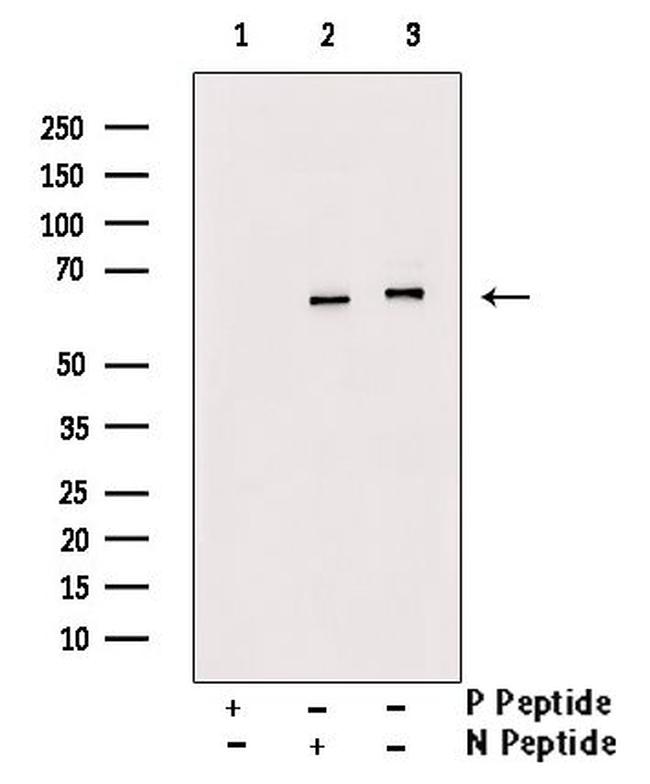 Phospho-NFkB p65 (Ser281) Antibody in Western Blot (WB)