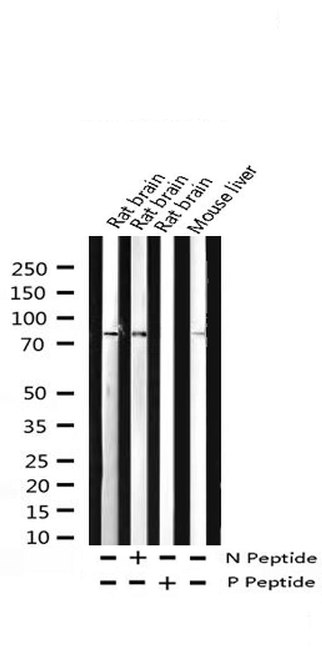 Phospho-PKC delta (Tyr313) Antibody in Western Blot (WB)