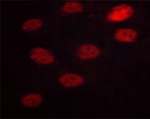 Phospho-NFATC3 (Ser165) Antibody in Immunocytochemistry (ICC/IF)