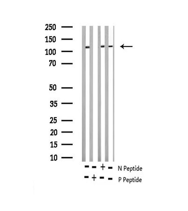 Phospho-NFATC3 (Ser165) Antibody in Western Blot (WB)