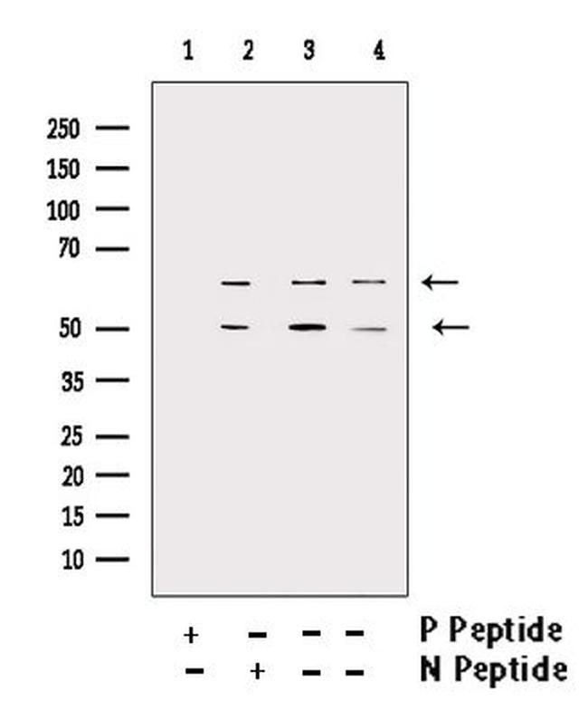 Phospho-CaMKII beta/gamma/delta (Thr287) Antibody in Western Blot (WB)