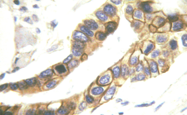 Phospho-ErbB4 (Tyr1284) Antibody in Immunohistochemistry (Paraffin) (IHC (P))