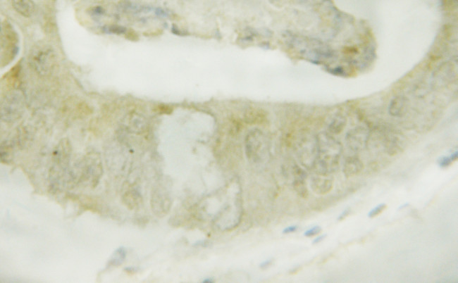 Phospho-LKB1 (Ser428) Antibody in Immunohistochemistry (Paraffin) (IHC (P))