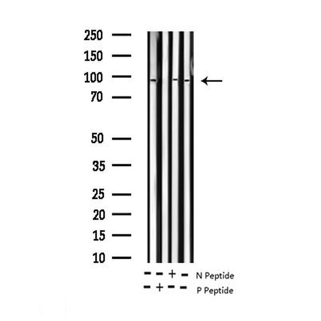 Phospho-ATRIP (Ser68) Antibody in Western Blot (WB)
