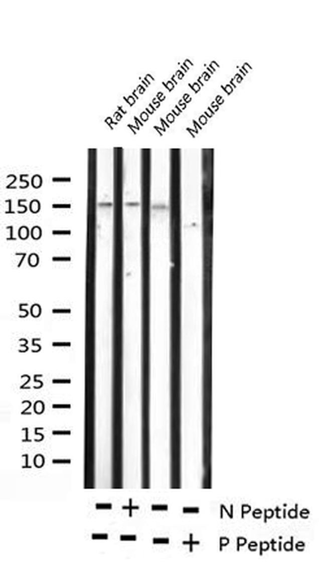 Phospho-ASK1 (Ser966) Antibody in Western Blot (WB)