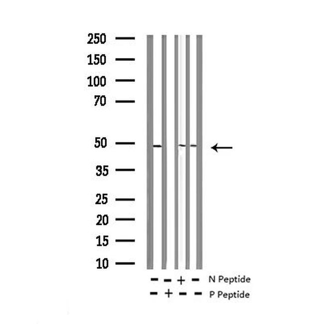 Phospho-HDAC8 (Ser39) Antibody in Western Blot (WB)