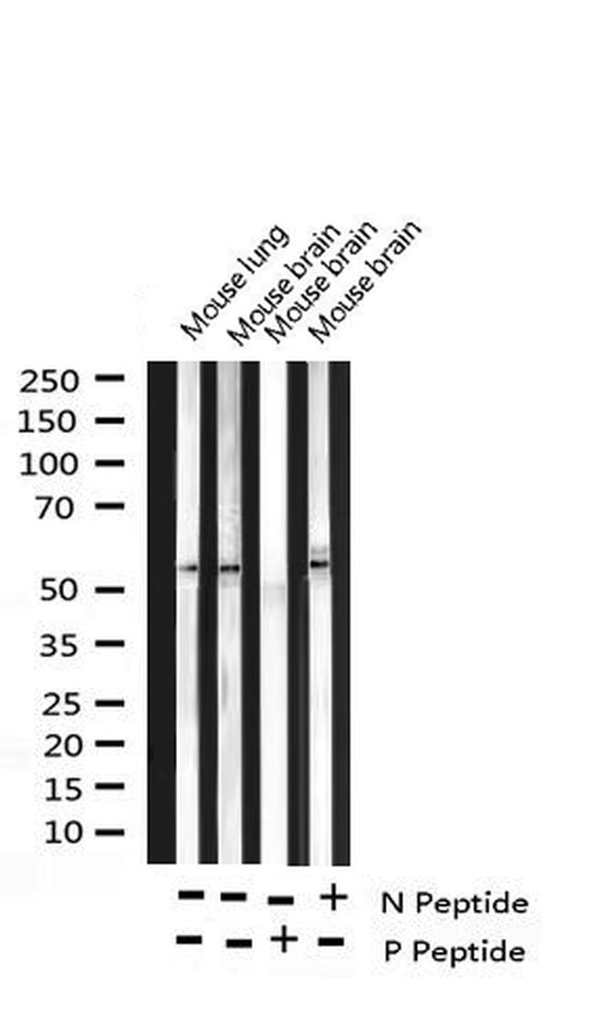 Phospho-RPS6KB2 (Ser423) Antibody in Western Blot (WB)