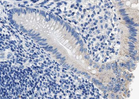 Phospho-DARPP-32 (Thr34) Antibody in Immunohistochemistry (Paraffin) (IHC (P))