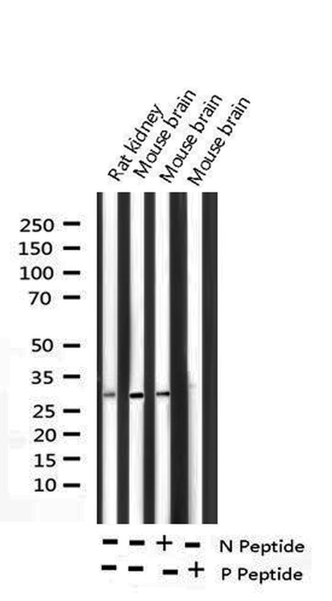 Phospho-DARPP-32 (Thr34) Antibody in Western Blot (WB)