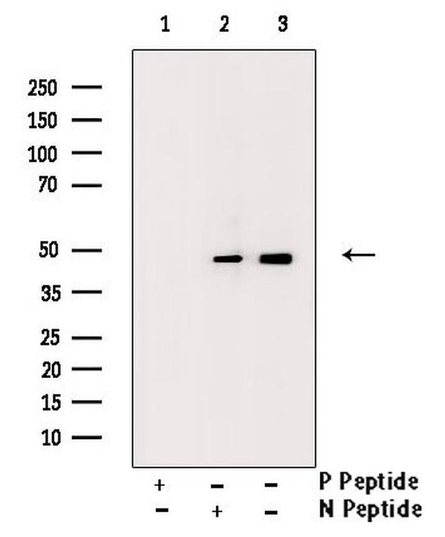 Phospho-IKK gamma (Ser85) Antibody in Western Blot (WB)