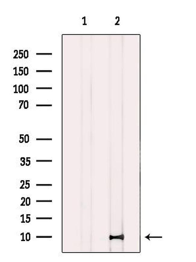CASPASE 1 P10 (CLEAVED ALA317) Antibody in Western Blot (WB)