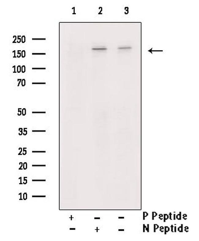 Phospho-ROCK1 (Tyr913) Antibody in Western Blot (WB)