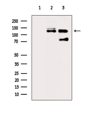 Phospho-MPRIP (Thr542) Antibody in Western Blot (WB)