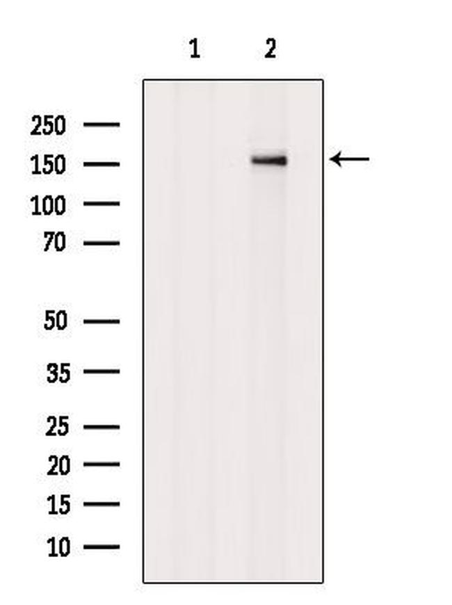 Phospho-MPRIP (Thr542) Antibody in Western Blot (WB)