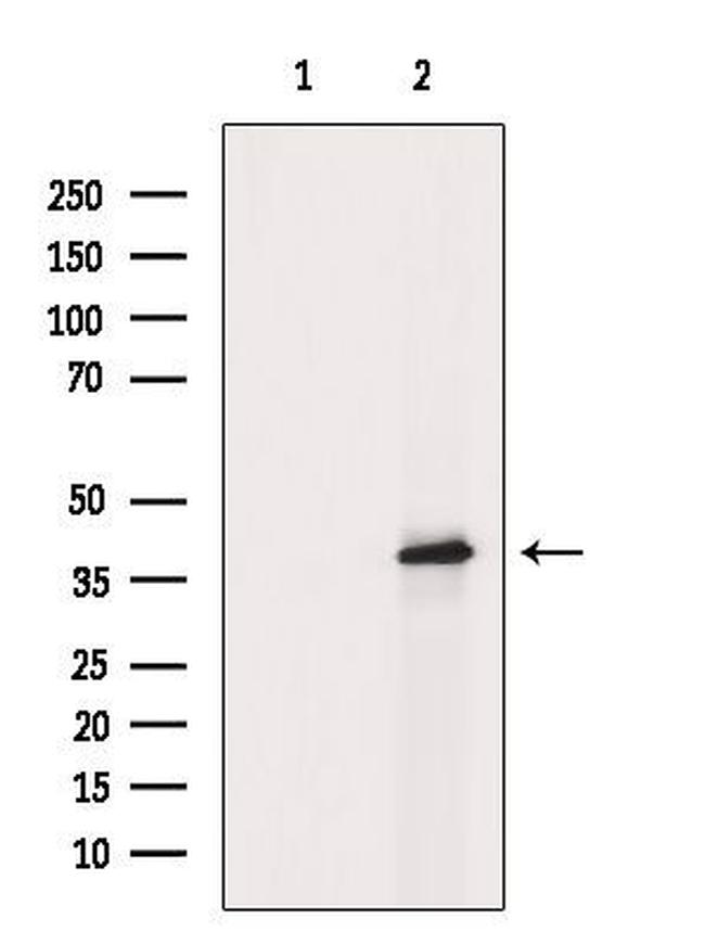 Phospho-GRAP2 (Thr262) Antibody in Western Blot (WB)