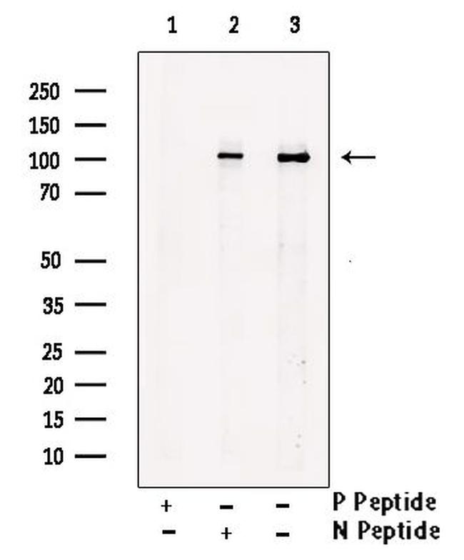 Phospho-ITCH / AIP4 (Tyr420) Antibody in Western Blot (WB)